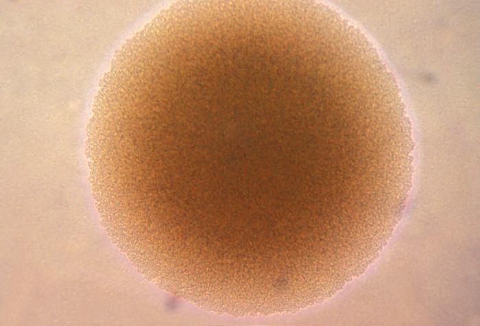 Fotomigrafía de una colonia de bacterias Neisseria gonorrhoeae (gonorrea). CORTESÍA