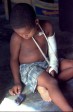 Quemaduras y fracturas fueron las secuelas más comunes entre los sobrevivientes. FOTO DIEGO GONZÁLEZ / EL COLOMBIANO