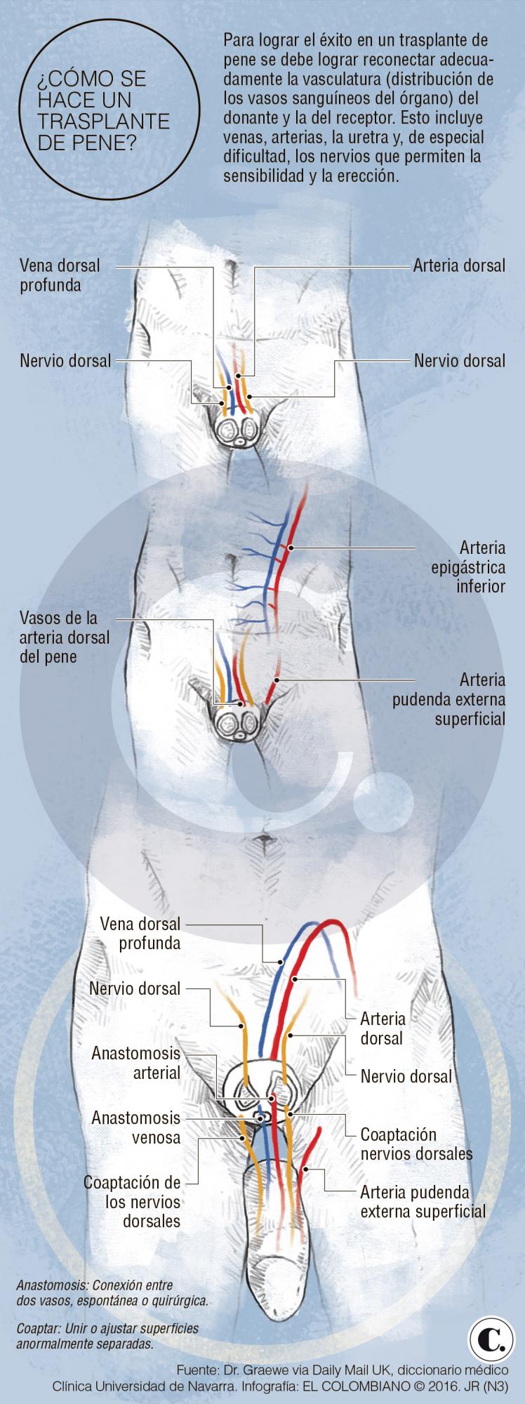 Segundo trasplante de pene tuvo éxito