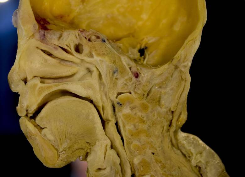 Poder observar el interior del cuerpo humano 