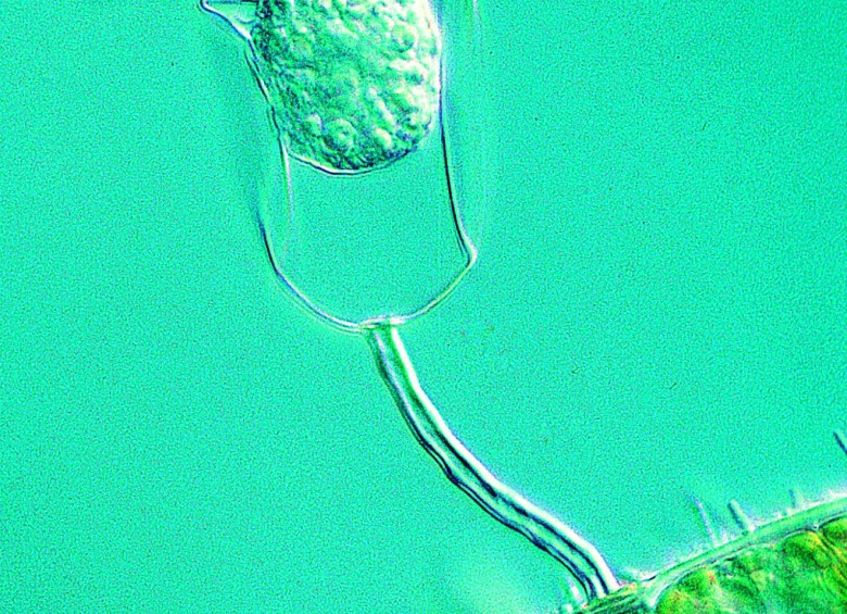 Protozoos acechados están unidos a algas verdes filamentosas con bacterias en su superficie. FOTO Paul W. Johnson