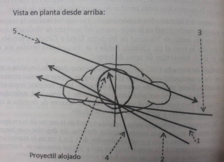 El tiro N°5, que impactó de izquierda a derecha, generó dudas en el nuevo dictamen. FOTOs cortesía