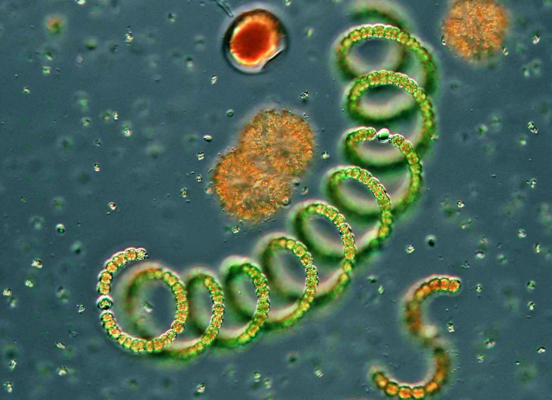 Cianobacterias filamentosas en espiral Anabaena sp. FOTO Ceske Budejovice / Nikon