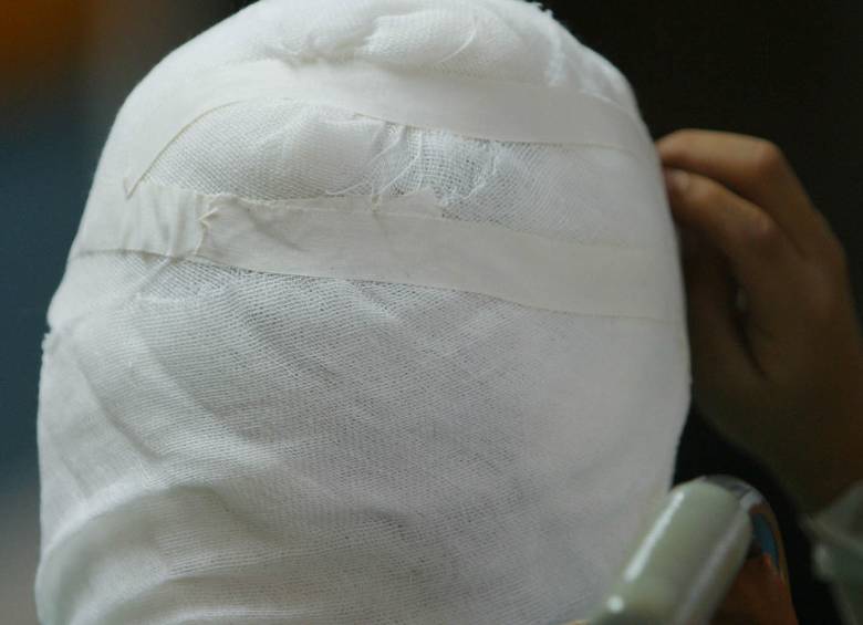 Los sitios anatómicos con mayor compromiso son la cara y las manos. FOTO ARCHIVO.