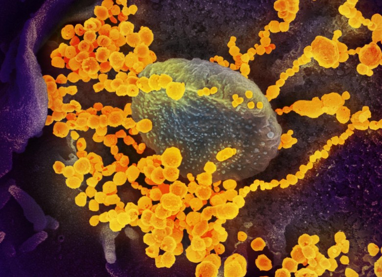 El tratamiento de baja dosis de dexametasona con esteroides es parte del mayor ensayo del mundo que prueba los tratamientos existentes para ver si también funcionan para el nuevo coronavirus. FOTO NIAID (Flickr)