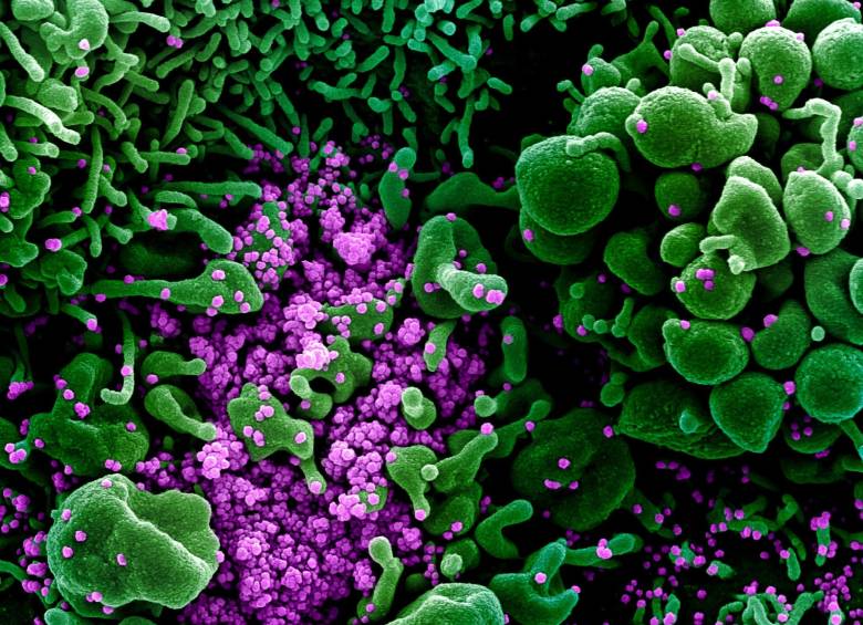 Los puntos morados en la imagen son las partículas víricas. En verde están las células en apoptosis, es decir, ‘suicidándose’ ante la infección del coronavirus SARS-CoV-2. El color es artificial. FOTO Instituto Nacional de Alergias y Enfermedades Infecciosas (NIAID, en inglés) de Estados Unidos . .
