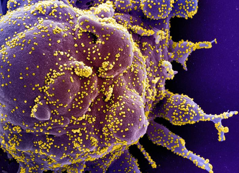La célula humana está coloreada en morado y, en amarillo, las partículas víricas. Está hecha gracias a un microscopio electrónico de barrido. FOTO Instituto Nacional de Alergias y Enfermedades Infecciosas (NIAID, en inglés) de Estados Unidos .