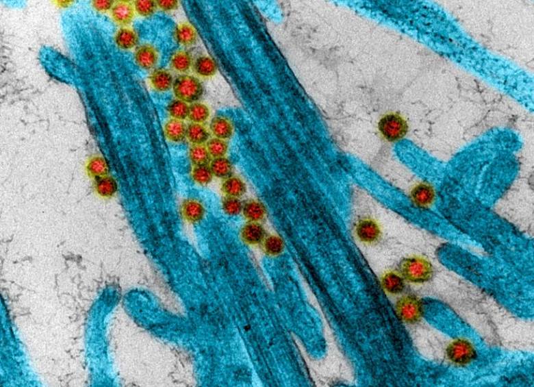 Imagen del coronavirus SARS-CoV-2 (en rojo). En azul, los cilios del epitelio respiratorio (son como “pelitos” del “revestimiento” de las vías respiratorias). FOTO Centro Nacional de Investigación Científica (CNRS, en francés).