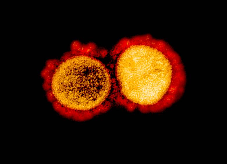 En estas dos fotos se observan partículas del virus vistas con un microscopio electrónico de transmisión. En el exterior se ven las “llaves” que usa el coronavirus para unirse a la “cerradura”’ que está en algunas de en las células y así poder infectarlas. FOTO Instituto Nacional de Alergias y Enfermedades Infecciosas (NIAID, en inglés) de Estados Unidos .