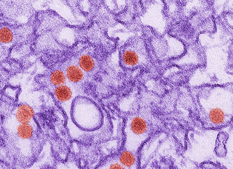 El descubrimiento de la estructura del virus del Zika, que publica hoy la revista “Science” en un nuevo estudio, representa un paso clave para desarrollar futuros tratamientos y vacunas. FOTO REUTERS