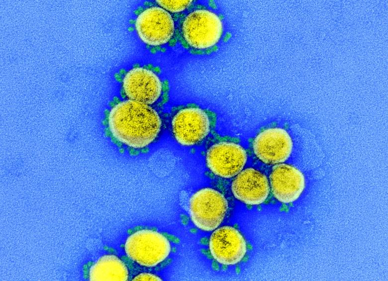 FOTO Instituto Nacional de Alergias y Enfermedades Infecciosas (NIAID, en inglés) de Estados Unidos .