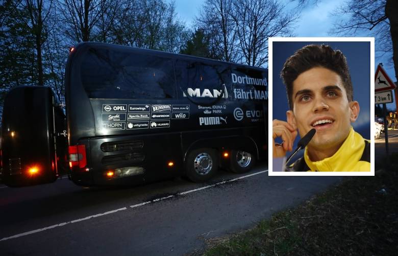 El jugador catalán del Borussia Dortmund, Marc Bartra salió herido tras la explosión. FOTO REUTERS