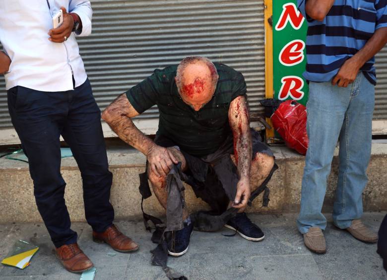 28 personas murieron y unas 100 resultaron heridas en un atentado con bomba en la ciudad de Suruç, en el sureste de Turquía. FOTO REUTERS