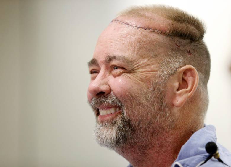 El paciente ofreció una rueda de prensa el pasado jueves en el hospital de Houston. FOTO AP