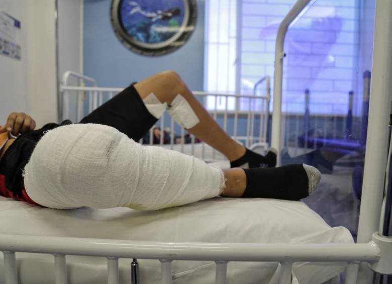 Según datos del INS, en diciembre del año pasado 509 personas resultaron quemadas con pólvora en el país. FOTO: COLPRENSA 