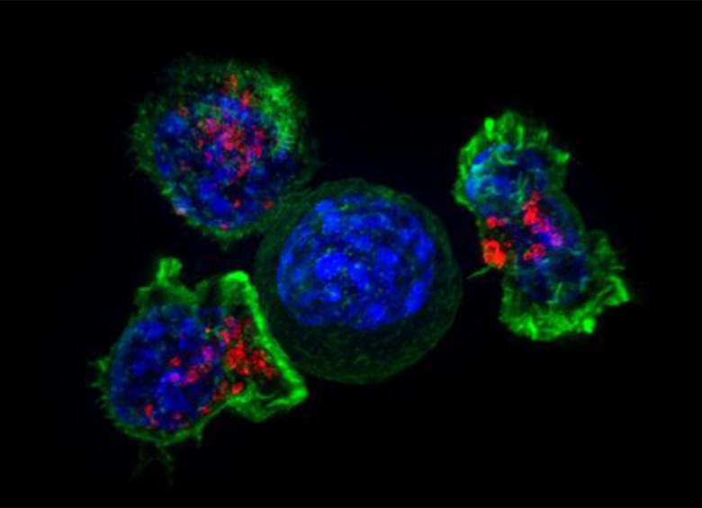 Una célula cancerosa está rodeada de células T asesinas inmunes. FOTO cortesía National Institutes of Health