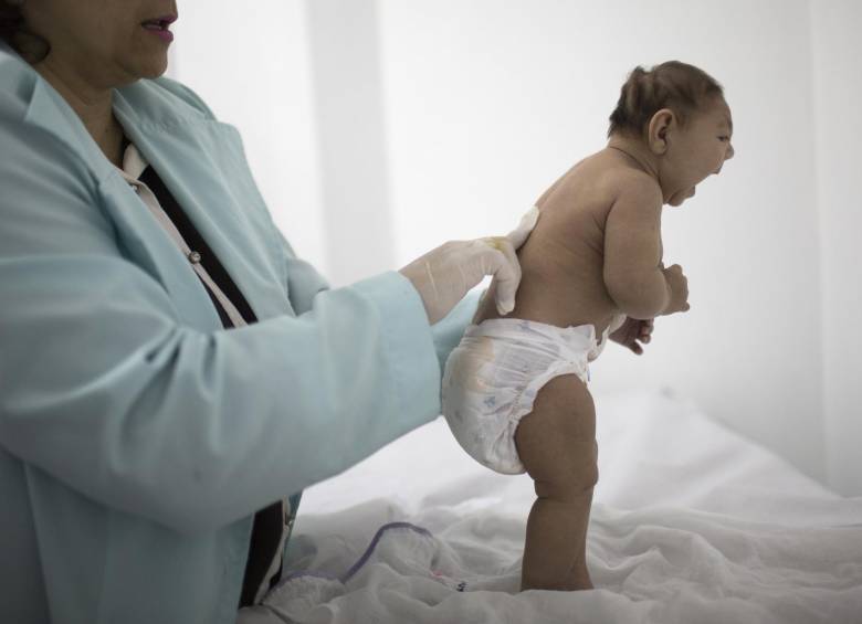 Los científicos concluyeron que la infección del virus de Zika en mujeres embarazadas es la causa de la malformación congénita conocida como microcefalia. FOTO AP