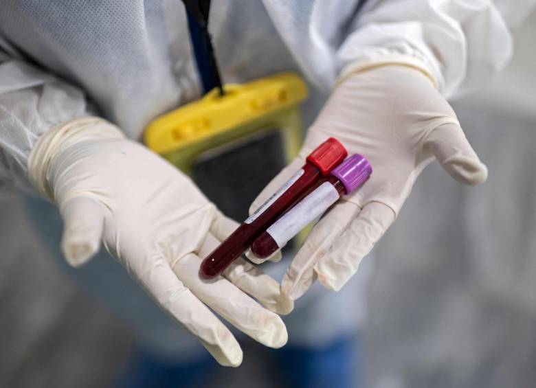 Solo existe un número limitado de pruebas de detección para unos pocos tipos de cáncer. Foto: AFP