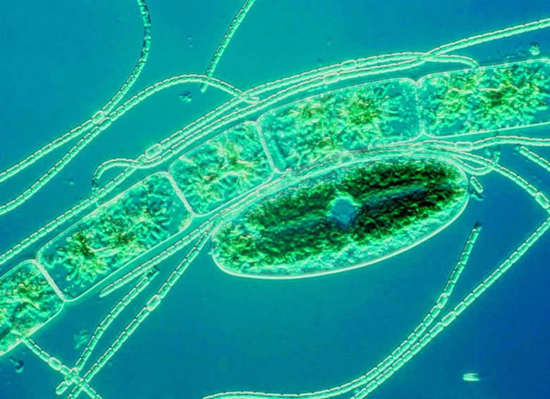 Anabaena sp. (cyanobacterium) y Netrium y Zygnema sp. (green algae). FOTO Dennis Kunkel Microscopy, Inc. / Nikon