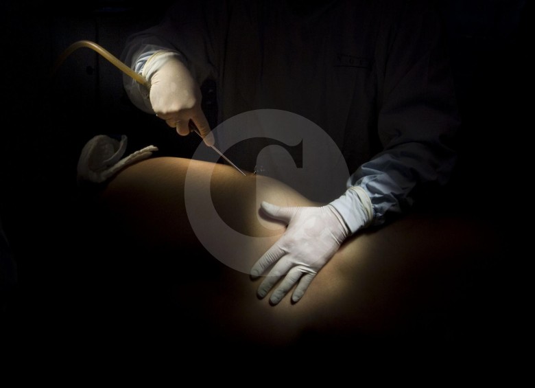 En la página web de la Sociedad Colombiana de Cirugía Plástica Estética y Reconstructiva usted puede verificar si su médico tiene los certificados antes de operar. FOTO esteban vanegas
