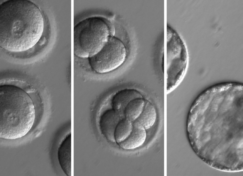 SEcuencia que muestra el desarrollo de embriones luego de la co-inyección de una enzima correctora del gen y espermatozoides de un donante con la mutación. Foto cortesía OHSU