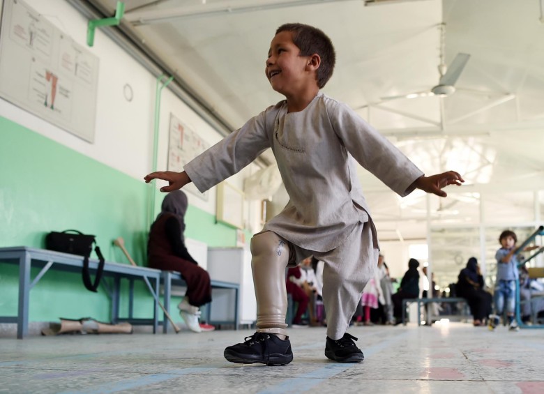 Ahmad Sayed Rahman sufrió las consecuencias de la guerra desde los 8 meses de edad. FOTO: AFP