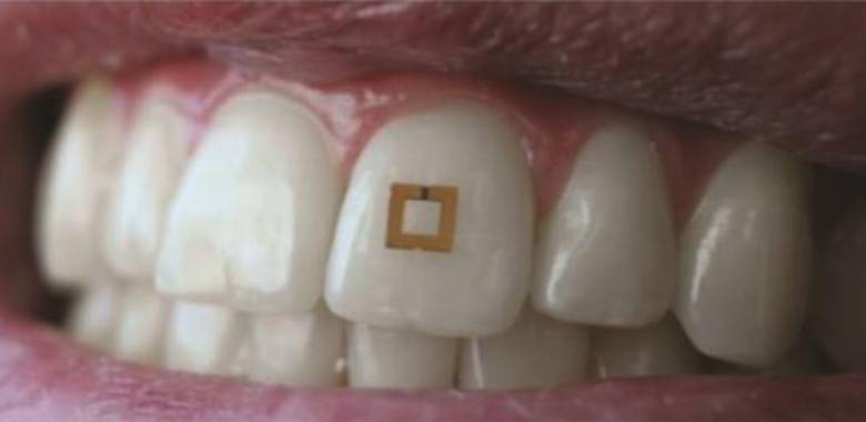 Los sensores están formados por tres capas intercaladas: una capa central bioreactiva que absorbe el nutriente y otros químicos que se detectarán, y las capas externas que consisten en dos anillos de oro de forma cuadrada / Fio Omenetto, Universidad de Tufts