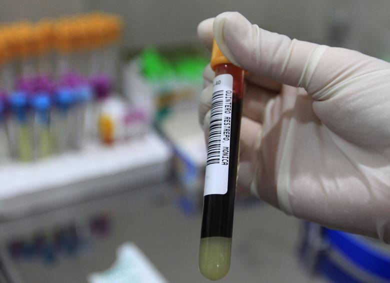 Casi un millón de personas mueren cada año por causas relacionadas con el VIH, a lo que hay que añadir la preocupación creciente por una nueva forma del virus resistente a los medicamentos. Foto Archivo: Robinson Sáenz