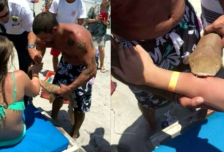 Una mujer de 23 años fue mordida por un pequeño tiburón nodriza en Boca Raton.